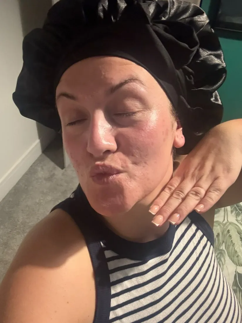 Amy with clear skin after coaching